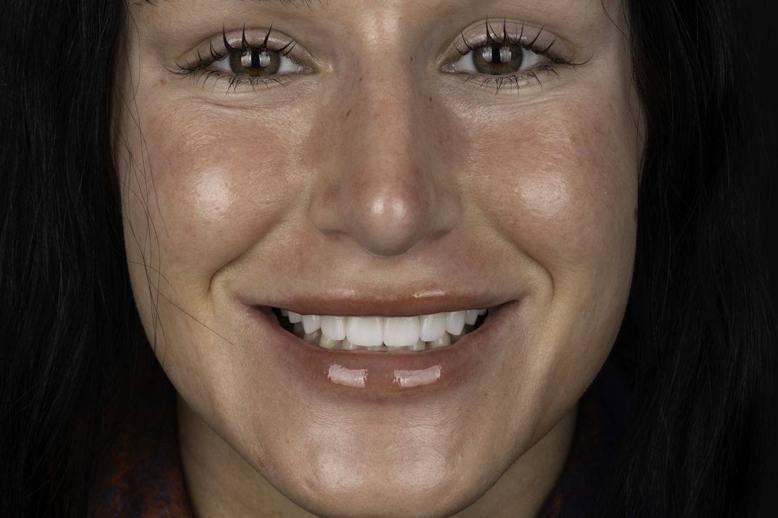 The same patient's smile after treatment